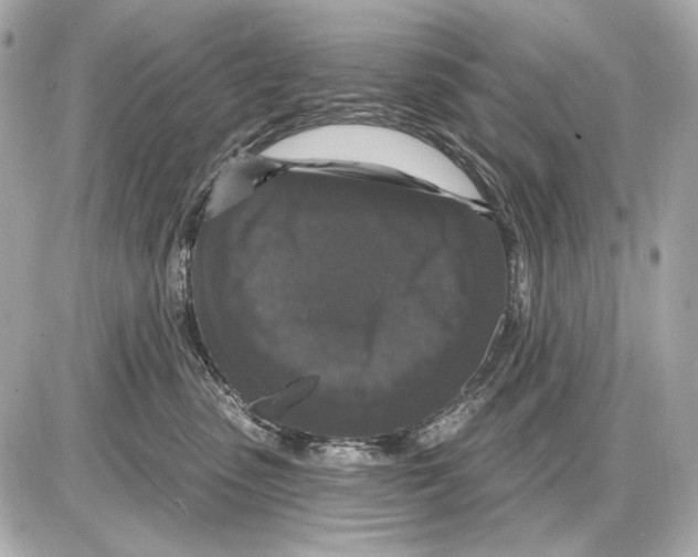 X0000085820475200704091637