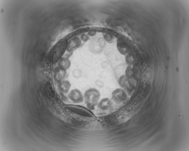 X0000085821255200704091623