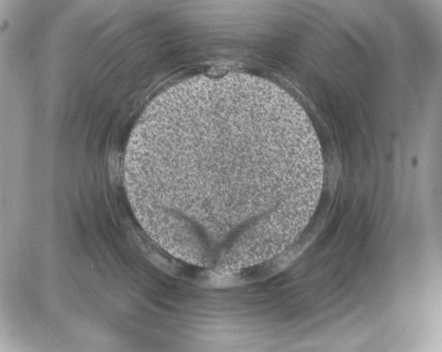 X0000085820093200704132023