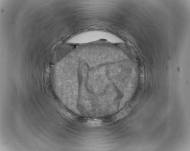 X0000085820369200704132018