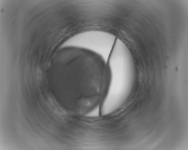 X0000085820370200704132018