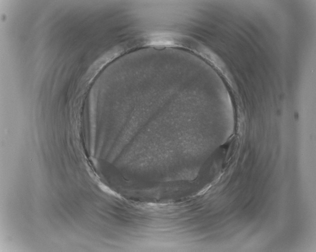 X0000085820385200704132017