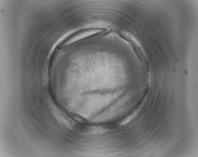 X0000085820392200704132017