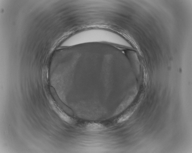 X0000085820397200704132017