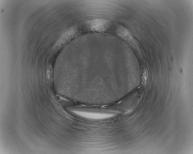 X0000085820424200704132017