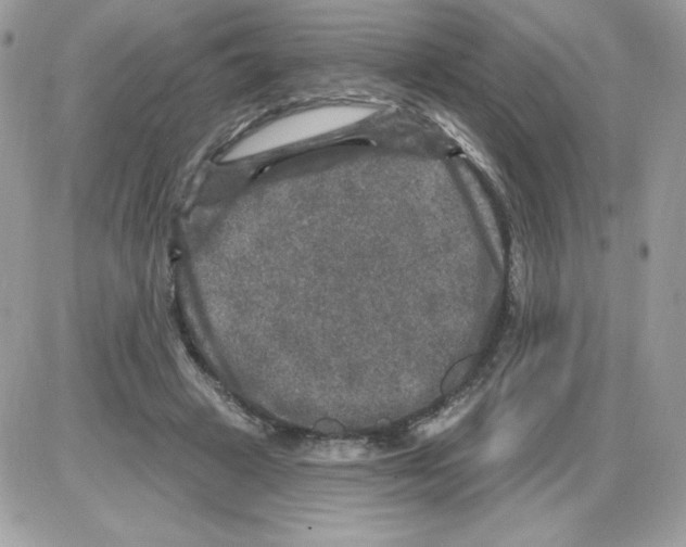 X0000085820449200704132016