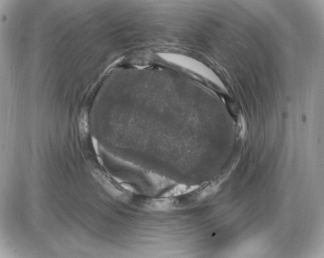 X0000085820479200704132017