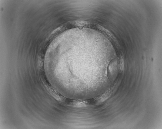 X0000085820569200704132015