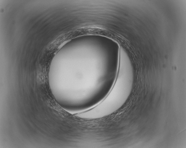 X0000085841014200703161050
