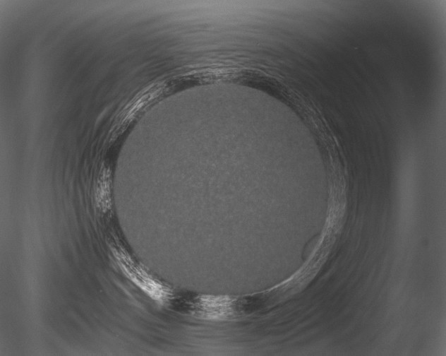 X0000085840144200703161401