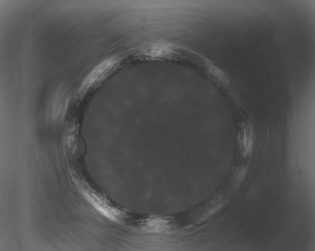 X0000085840462200703161355