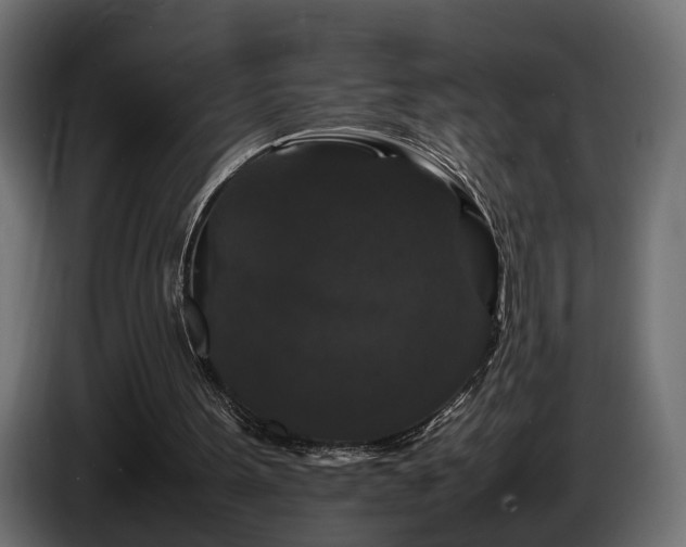 X0000085840099200703231451