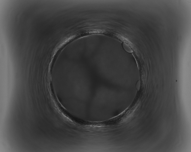 X0000085840721200703231442