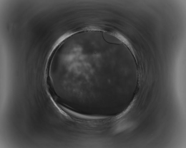X0000085841141200703231436