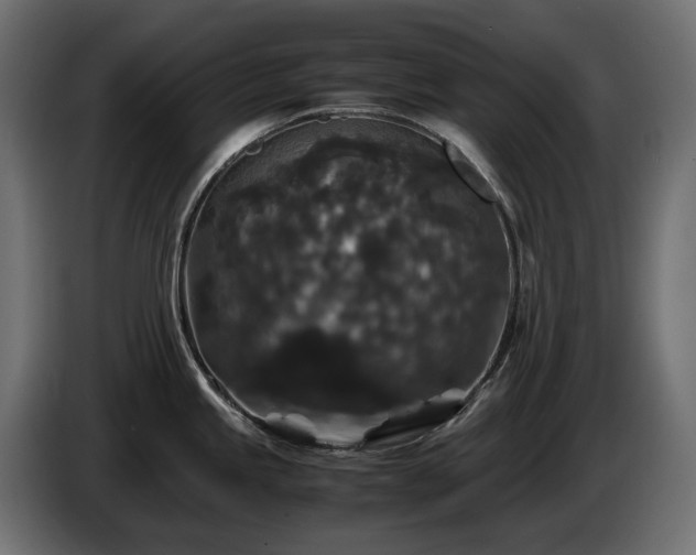 X0000085841245200703231435