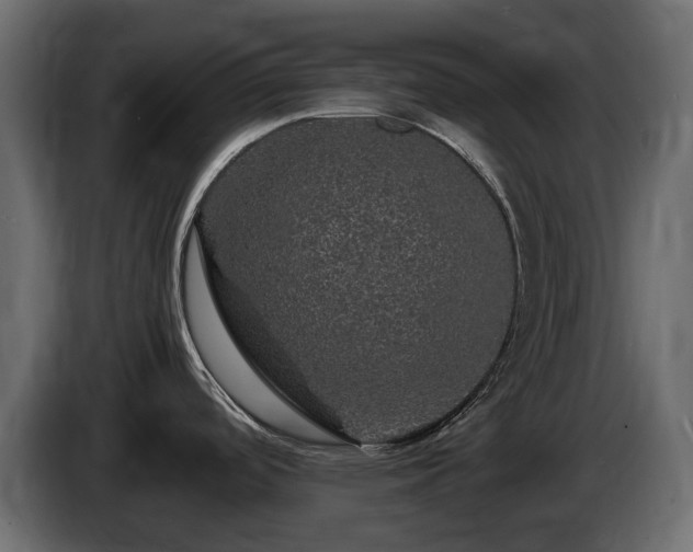 X0000085841488200703231431