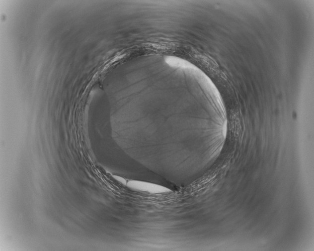 X0000085841009200704091718