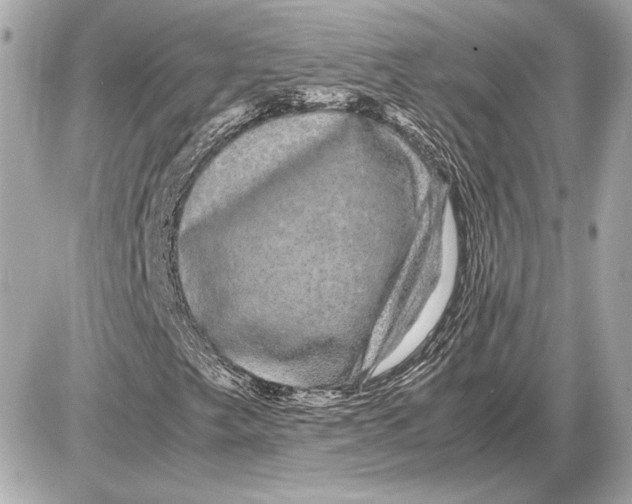 X0000085841249200704091714