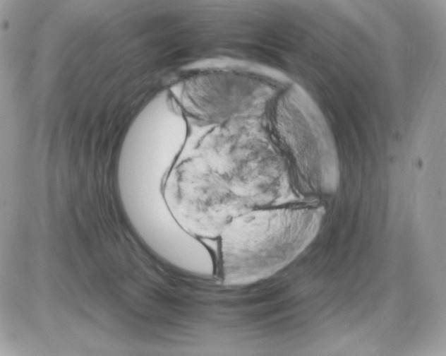 X0000085840177200704132113