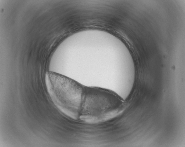 X0000085840365200704132109