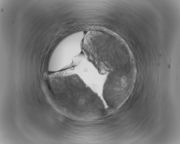 X0000085840699200704132104