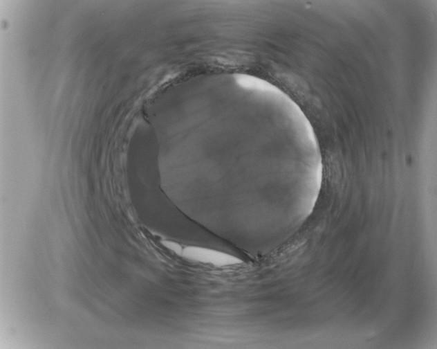 X0000085841009200704132057