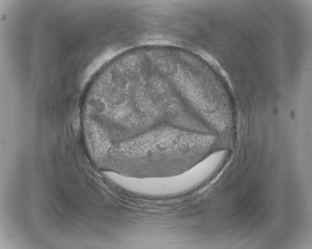 X0000085841167200704132056