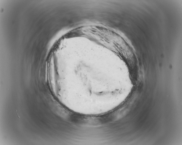 X0000085841175200704132055