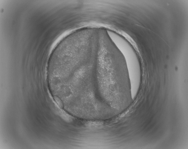 X0000085841183200704132055