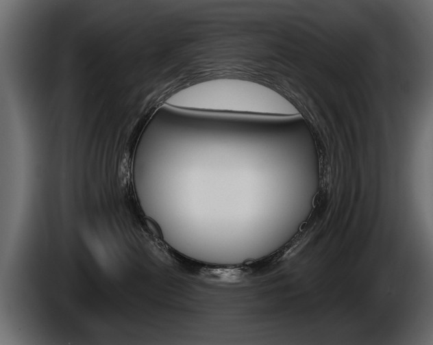 X0000086000478200703230853