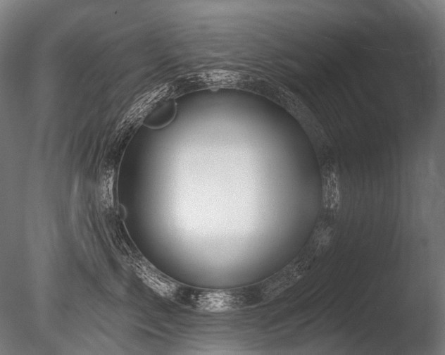 X0000086000717200703231145