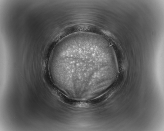 X0000086000759200704091037