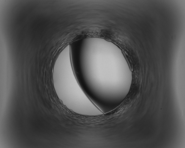 X0000086011057200703230906