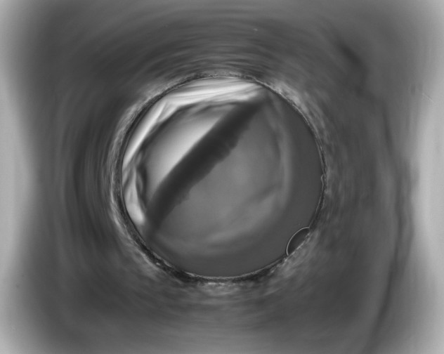 X0000086010145200704091102