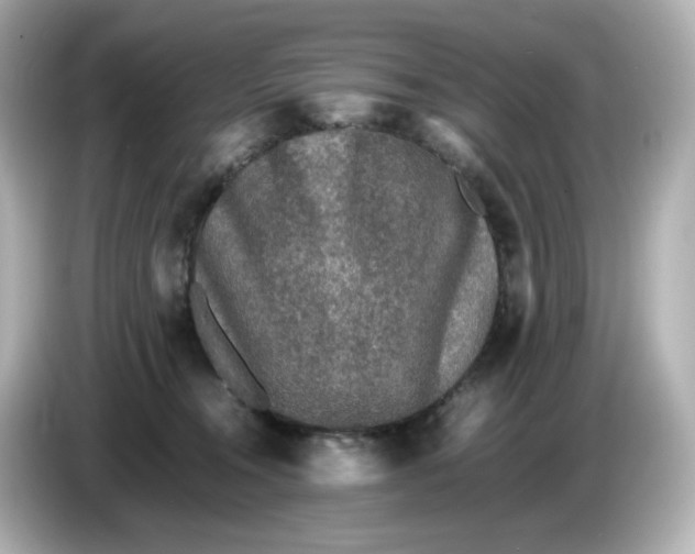 X0000086010372200704091100