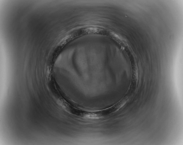 X0000086010759200704091055