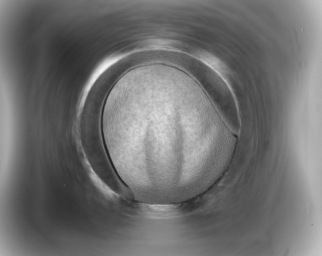 X0000086011152200704091051