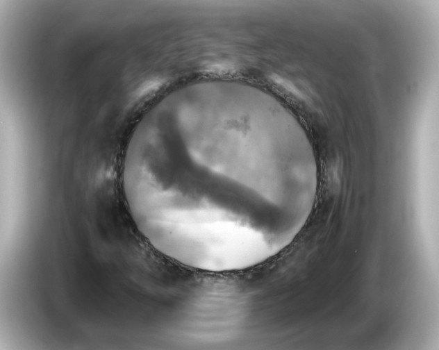 X0000086011254200704091049
