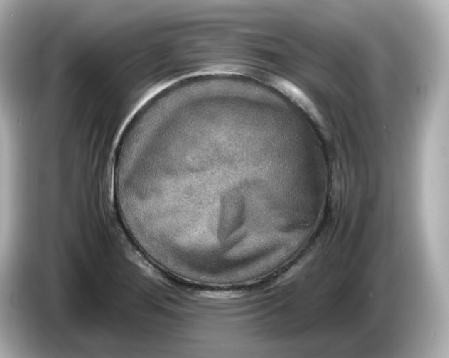 X0000086011276200704091049