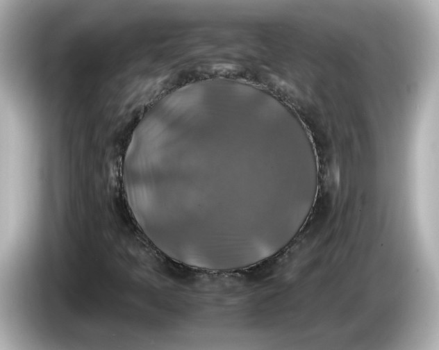 X0000086011397200704091047