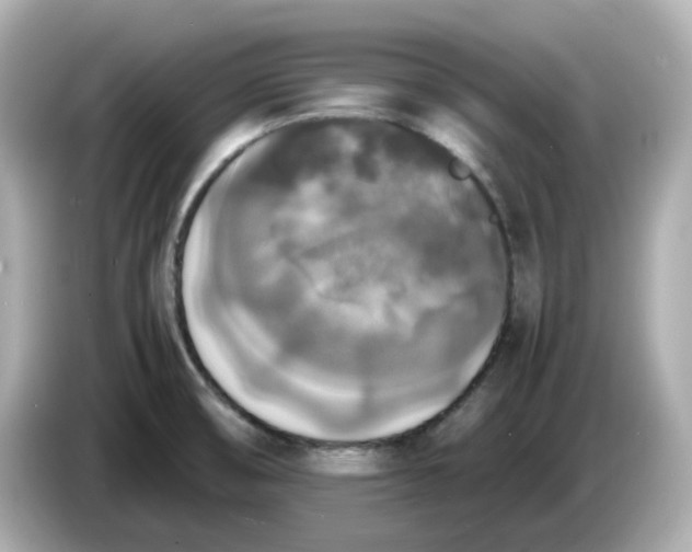 X0000086011474200704091047