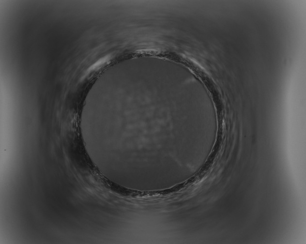 X0000086011351200704131818