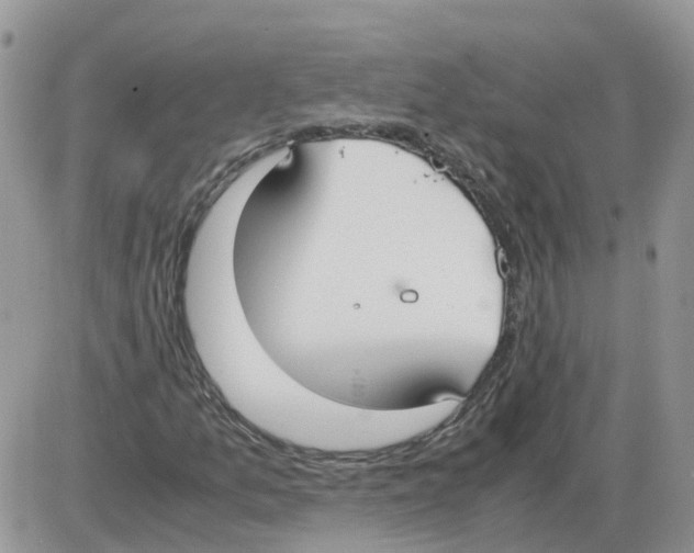 X0000086011157200704201849