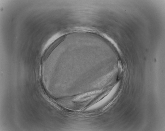 X0000086011365200704201846