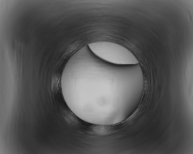X0000086020142200703230941