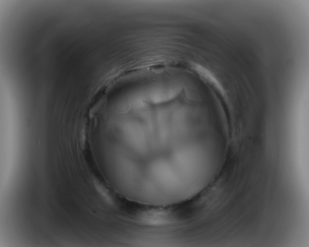 X0000086020065200703301041