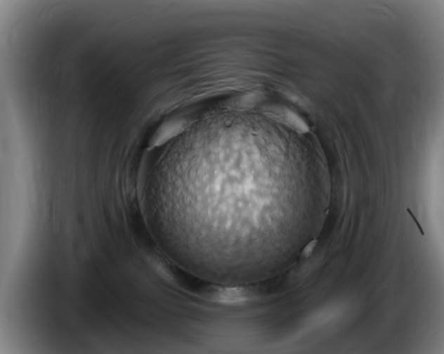 X0000086020091200703301042