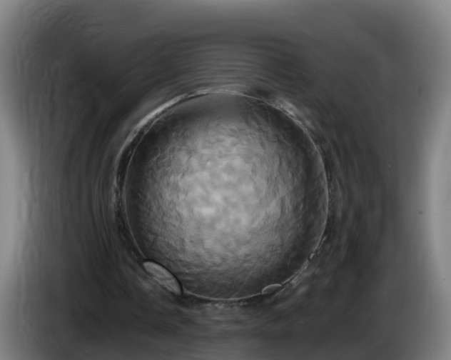 X0000086020338200703301037