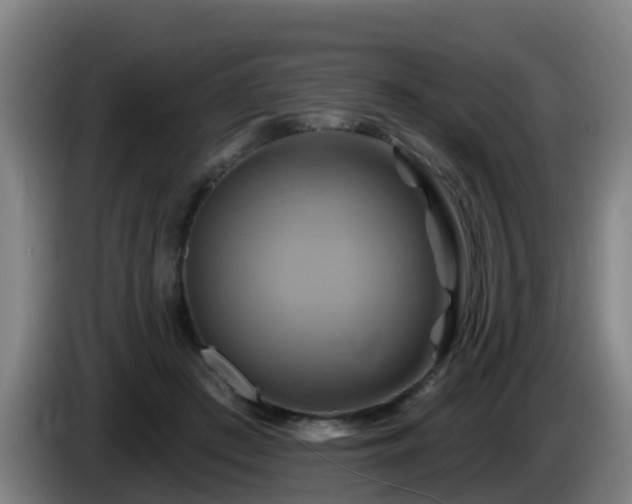 X0000086020409200703301036
