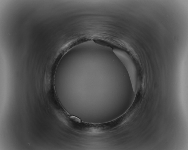X0000086020496200703301035